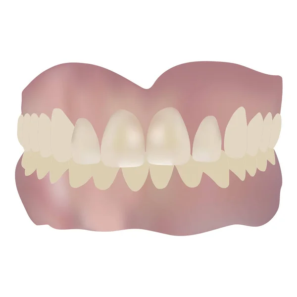 Human Jaw Teeth Vector Drawing Illustration — Stock Vector