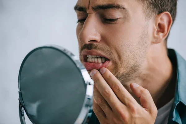 Genç Adam Aynaya Bakarak Diş Ağrısı Ile Yakından Görmek — Stok fotoğraf