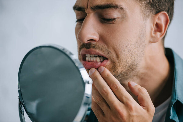 close-up view of young man with tooth pain looking at mirror 