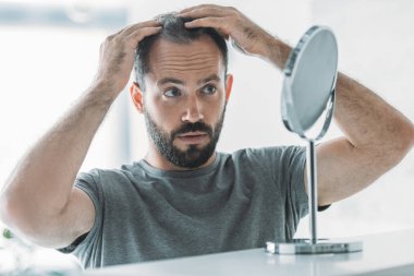 bearded mid adult man with alopecia looking at mirror, hair loss concept clipart