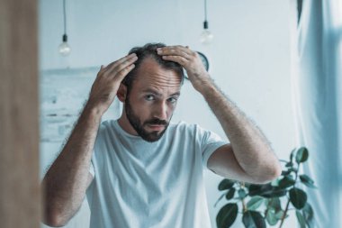 ayna, saç kaybı kavramı seyir alopesi ile orta yetişkin adam 