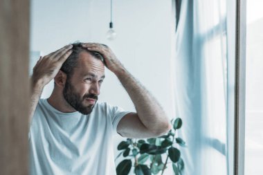 Alopesia hastası, üzgün orta yaşlı bir adam aynaya bakıyor, saç dökülmesi konsepti