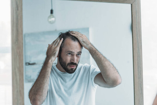 middle aged man with alopecia looking at mirror, hair loss concept 