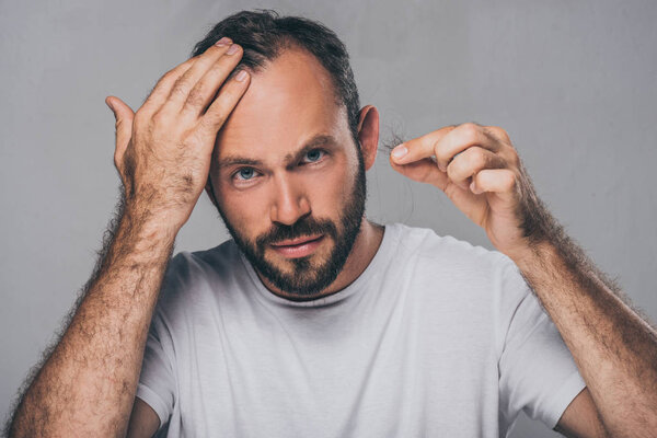 bearded middle aged man holding fallen hair and looking at camera isolated on grey