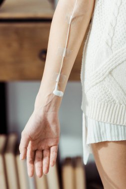 Kadın el tıbbi IV infüzyon, müzik konsepti gibi beyaz kulaklık ile yakın çekim 