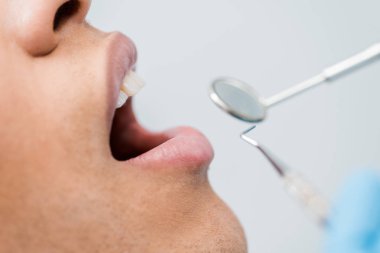 açık ağız diş kliniğinde muayene sırasında olan Afrika kökenli Amerikalı adam kırpılmış görünümünü 