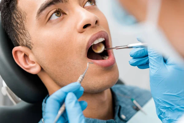 Närbild Afroamerikanska Man Med Öppen Mun Granskning Tandvårdsklinik — Stockfoto