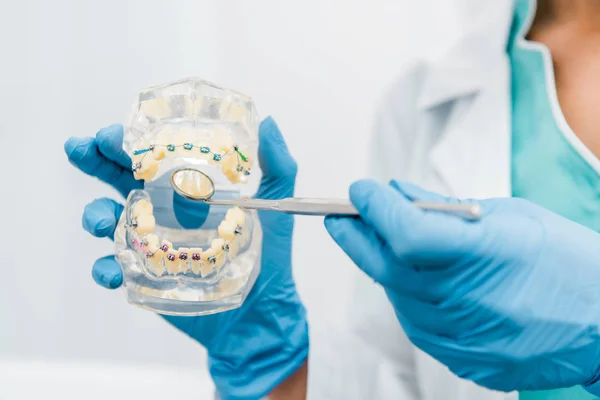 Bijgesneden Weergave Van Tandheelkundige Kaak Model Handen Van Stomatologist Latex — Stockfoto