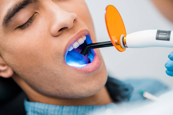 закрытие африканского американца во время процедуры отбеливания
 