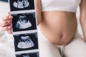 Oříznutý pohled těhotná žena ukazuje ultrazvukové vyšetření