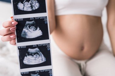Cropped view of pregnant woman showing ultrasound scans clipart