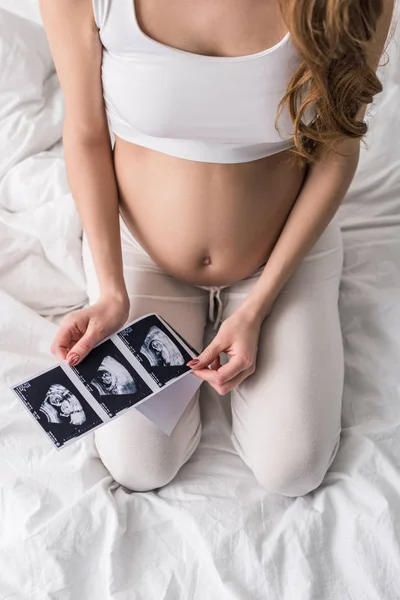 Vista Parcial Mujer Embarazada Con Ecografías —  Fotos de Stock