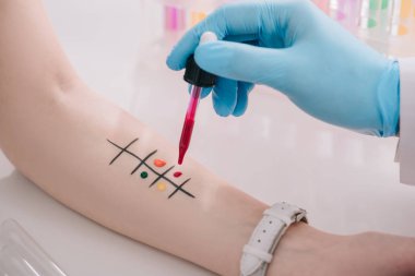 Doktor holding pipet alerji testi yaparken sıvı ile kırpılmış görünümünü