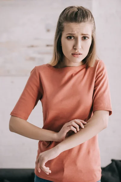 Sad Blonde Woman Scratching Hand While Having Allergy — Stock Photo, Image