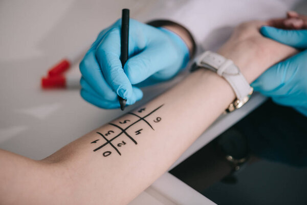 обрезанный вид врача в латексных перчатках, держащего маркер ручкой рядом с отмеченной женской рукой
  