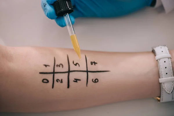 Top View Doctor Holding Pipette Liquid Marked Female Hand — Stock Photo, Image