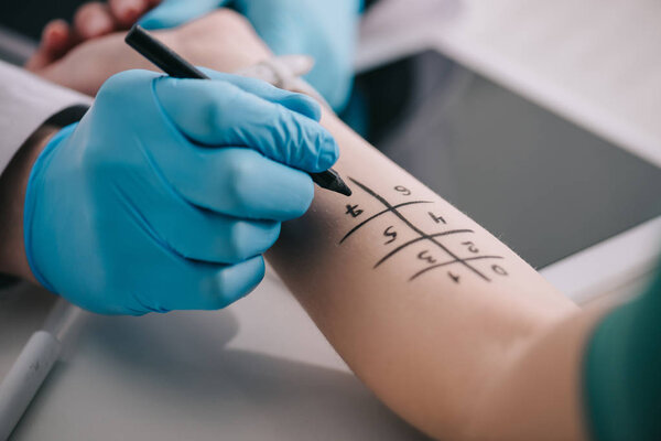 обрезанный вид врача в латексных перчатках, держащего маркер ручкой возле женской руки
  