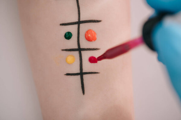 вид сверху на врача, держащего пипетку с жидкостью рядом с обозначенной рукой женщины
  