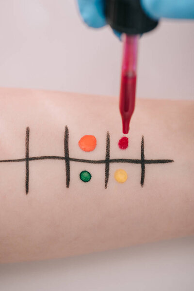 Закрыть пипетку с жидкостью при проведении тестов на аллергию
 