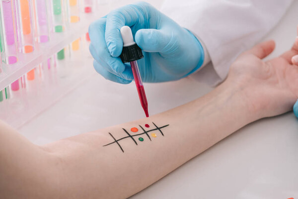 обрезанный вид врача в латексной перчатке, держащего пипетку с жидкостью во время проведения тестов на аллергию
 