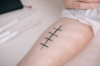 işaretli erkek eli kırpılmış görünümünü klinik beyaz yüzey üzerinde 