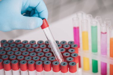 lateks eldiven cam tüp bebek tutan doktor kırpılmış görünümünü