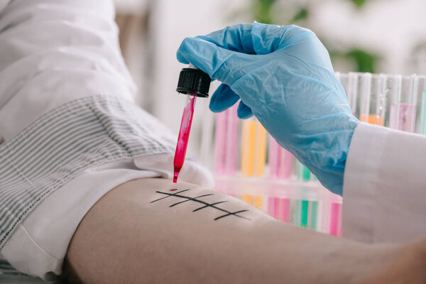 обрезанный вид врача в латексной перчатке, держащего пипетку с красной жидкостью рядом с отмеченной мужской рукой в лаборатории
 