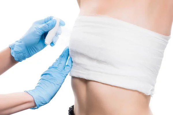 Cropped View Plastic Surgeon Blue Latex Gloves Bandaging Breast Woman — Stock Photo, Image