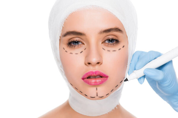 обрезанный вид пластического хирурга в латексной перчатке с маркерной ручкой рядом с привлекательной девушкой с отметинами на лице, изолированными на белом
 