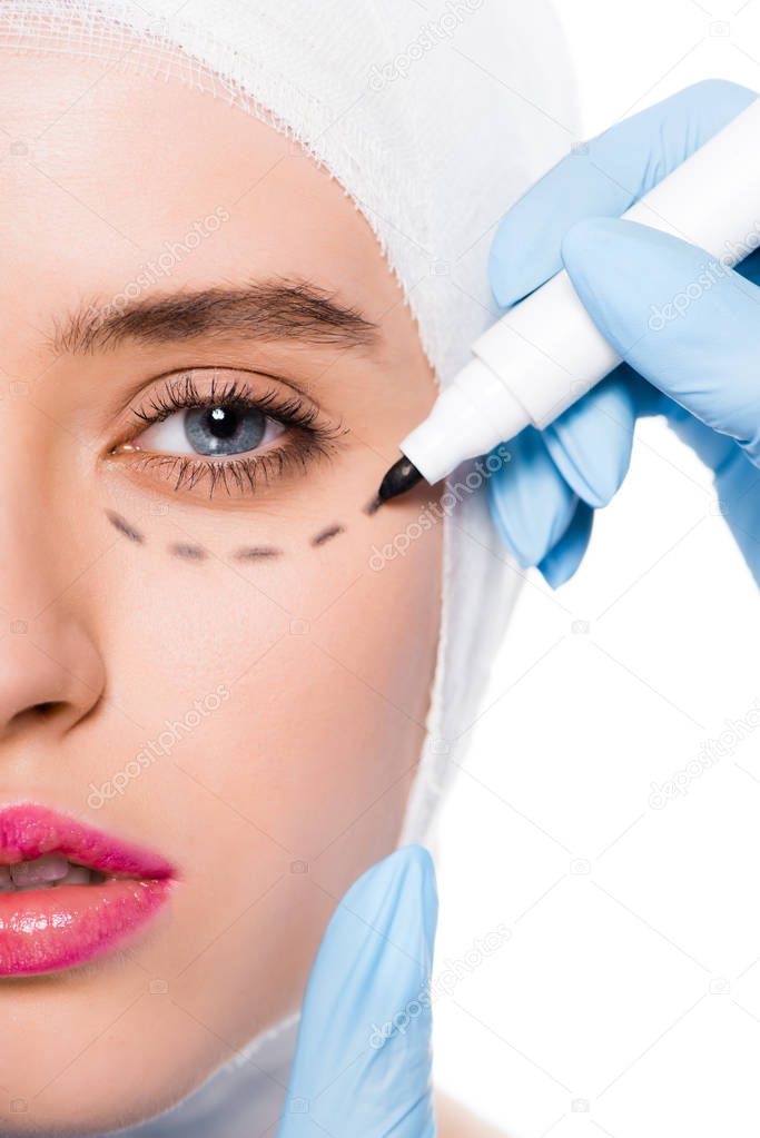 cropped view of plastic surgeon in blue latex glove holding marker pen near woman with marks on face isolated on white 