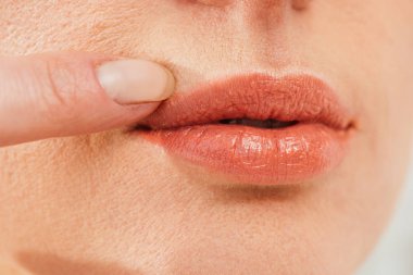 cropped view of sick woman touching herpes on lips  clipart