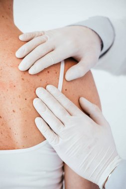 lateks eldivende dermatolog kırpılmış görünümü sırt beyaz izole melanom ile kadın inceleyerek 