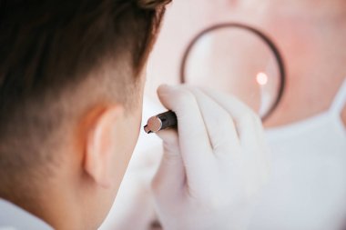 melanom lu kadının yakınında büyüteç tutan dermatologun kırpılmış görünümü 