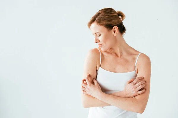 Frau Mit Hauterkrankung Kratzende Haut Isoliert Auf Weiß — Stockfoto