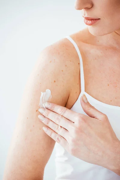 Vista Recortada Mujer Enferma Aplicando Crema Cosmética Sobre Blanco — Foto de Stock