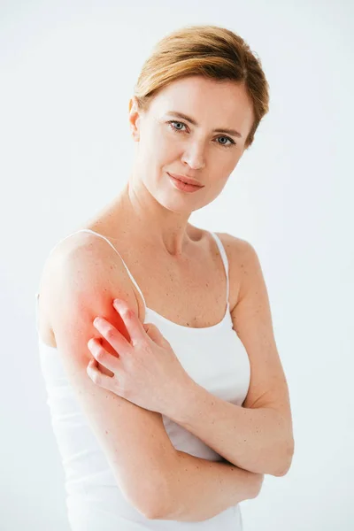 Mujer Alérgica Atractiva Rascarse Piel Roja Blanco — Foto de Stock