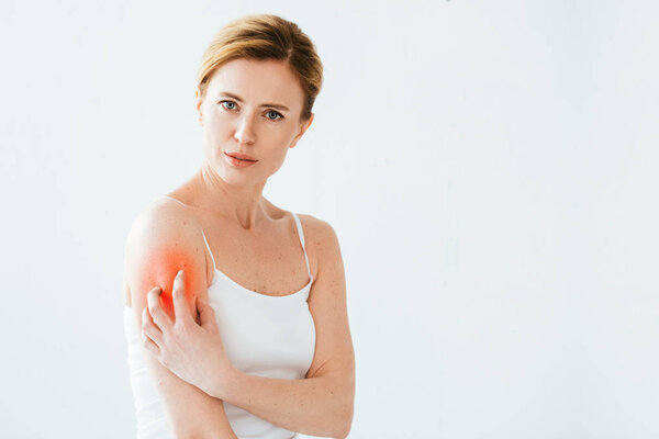attractive allergic woman scratching red skin and looking at camera on white 