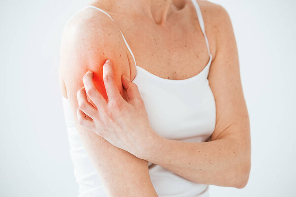cropped view of allergic woman scratching red skin on white 
