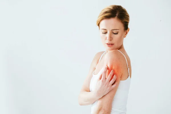 Mulher Muito Doente Com Alergia Arranhando Pele Vermelha Branco — Fotografia de Stock