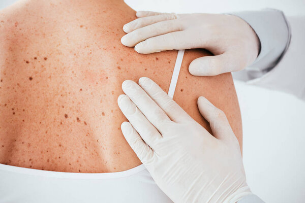 cropped view of dermatologist in latex gloves examining woman with skin disease  isolated on white 