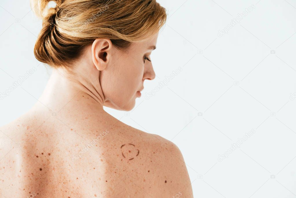attractive woman with marks on back isolated on white  