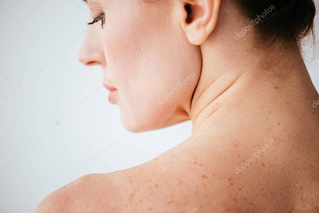 close up of nude woman with melanoma on skin on white 