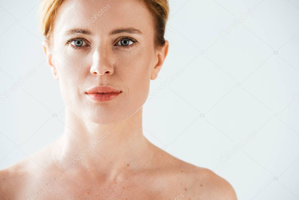naked beautiful woman with skin illness looking at camera on white 