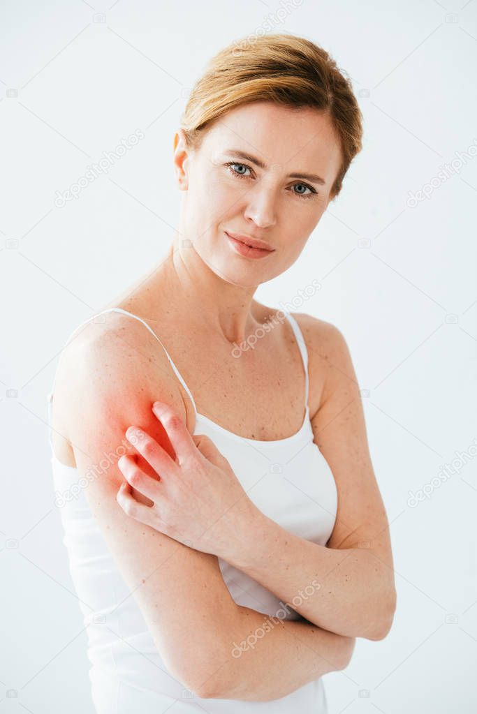 attractive allergic woman scratching red skin on white 