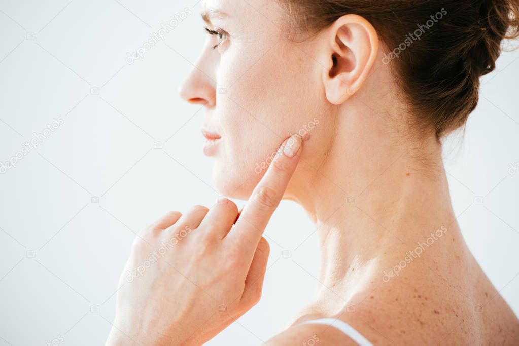 attractive woman pointing with finger at mole on face isolated on white 