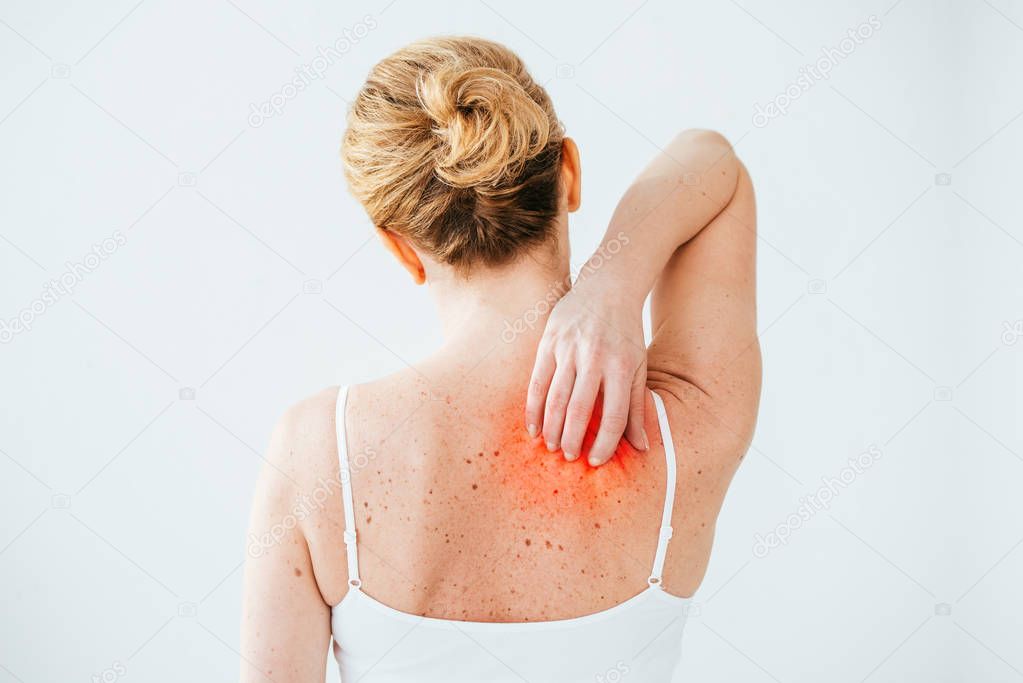 cropped view of sick woman with allergy scratching red skin isolated on white 