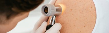 cilt hastalığı olan hastayı incelerken dermatoskop tutan lateks eldivenlerde dermatologun panoramik çekimi  