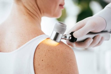 hasta incelerken dermatoskop tutan dermatolog kırpılmış görünümü  