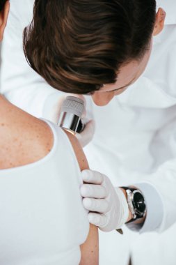 melanom lu hastayı incelerken dermatoskop tutan dermatologun kırpılmış görünümü 