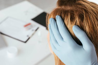klinikte hastanın saç inceleyen mavi lateks eldiven dermatolog kırpılmış görünümü 